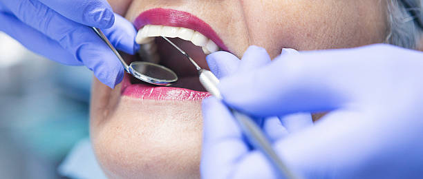 Best Knocked-Out Tooth (Avulsed Tooth) Treatment in Icard, NC